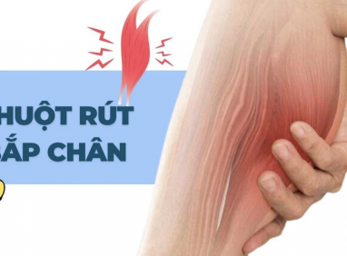 Chuột Rút Bắp Chân Có Liên Quan Đến Bệnh Lý Cơ Xương Khớp Không?
